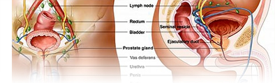 prostate disorder